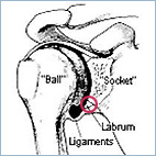 Labral Tear – Dutcher-Dash